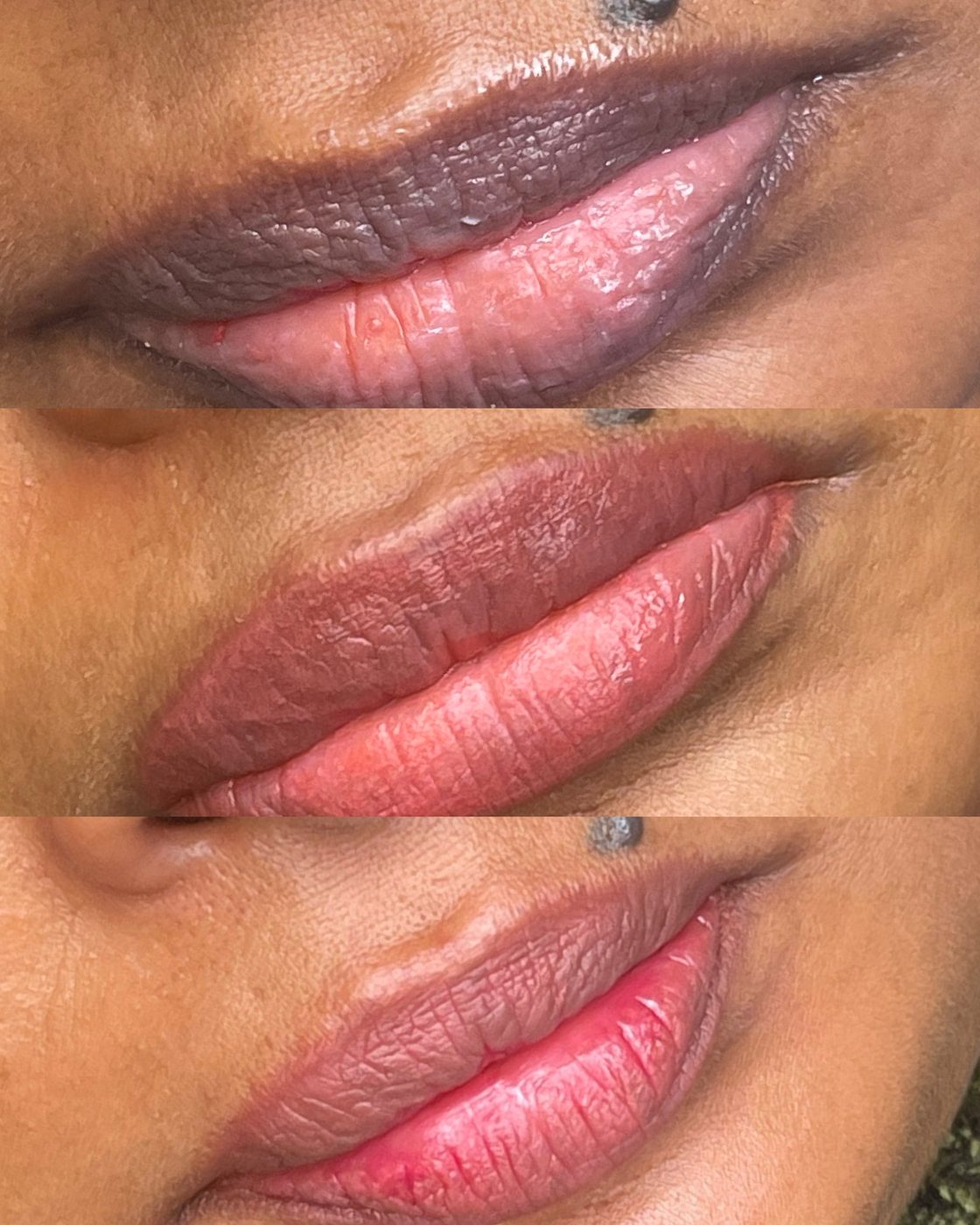 Lip Neutralisation