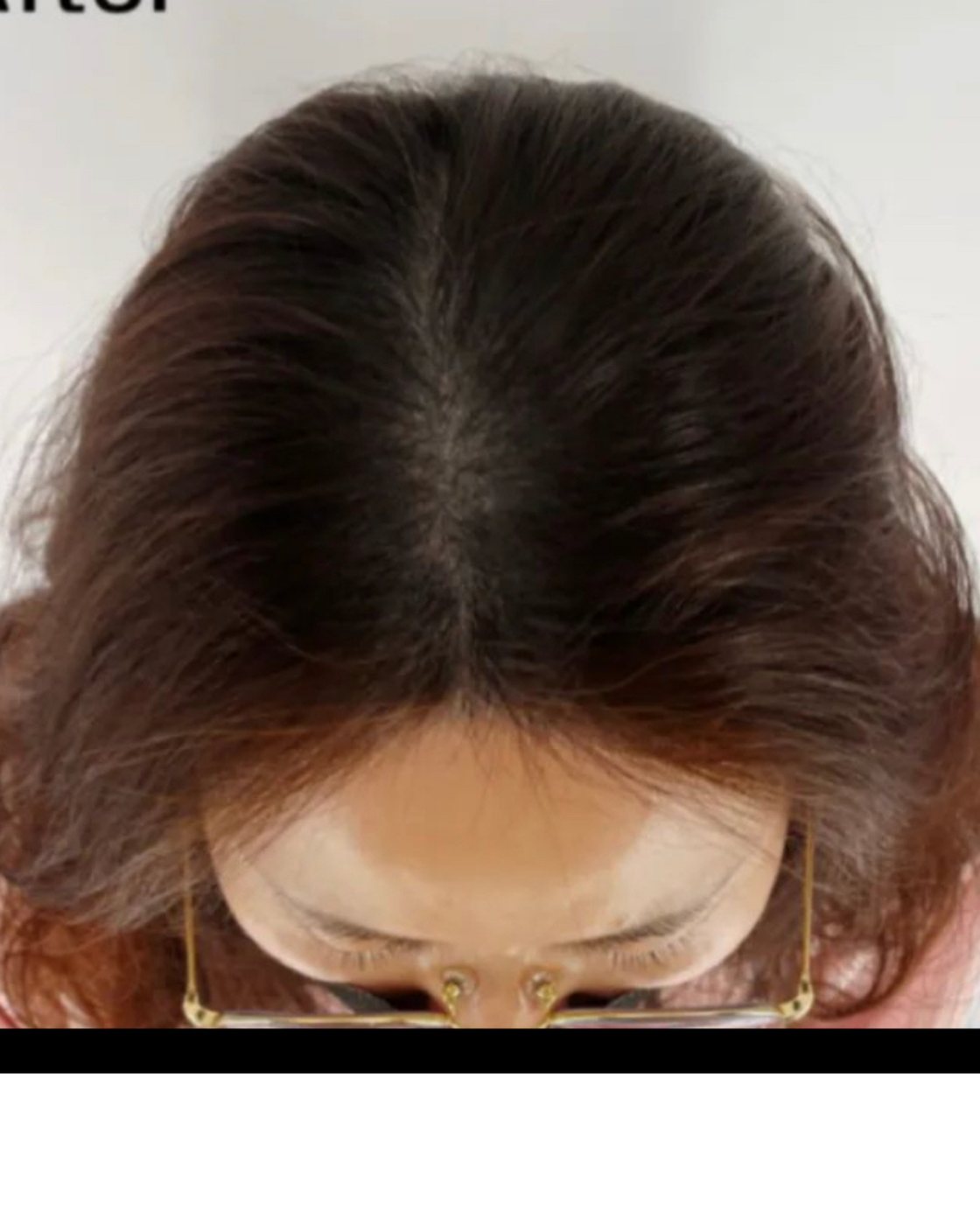 Perma Scalp After
